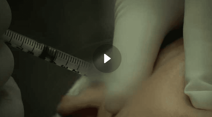 [TV조선] 물광주사가 도수치료로…보험 사기일당 270여 명 적발